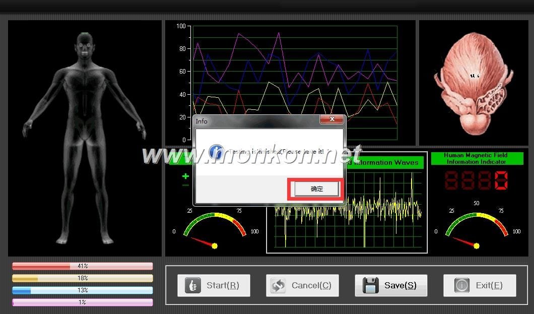 quantum-resonance-magnetic-analyzer-english-3-99-version-software